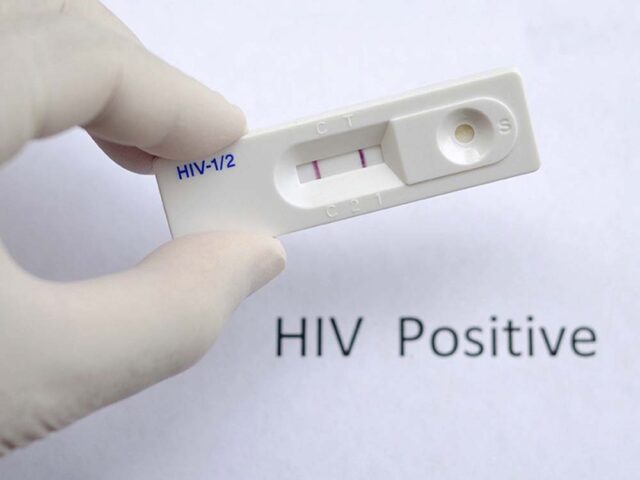 hiv.jpg