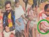 पत्थर जैसी बन रही बच्ची का होगा इलाज, बाल आयोग ने मामले में दिखाई सक्रियता